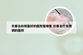 长春治白斑最好的医院是哪里 长春治疗白斑病的医院