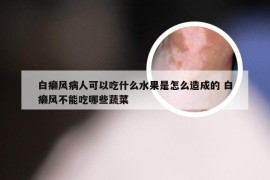 白癞风病人可以吃什么水果是怎么造成的 白癞风不能吃哪些蔬菜