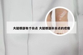 大腿根部有个白点 大腿根部长白点的疙瘩