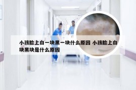 小孩脸上白一块黑一块什么原因 小孩脸上白块黑块是什么原因