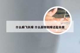 什么癣飞长痒 什么藓特别痒还起白屑