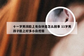 十一岁男孩脸上有白块是怎么回事 11岁男孩子脸上好多小白疙瘩