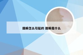 圆癣怎么引起的 圆癣是什么