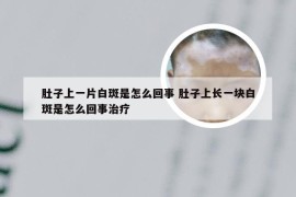 肚子上一片白斑是怎么回事 肚子上长一块白斑是怎么回事治疗