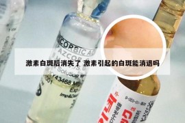 激素白斑后消失了 激素引起的白斑能消退吗