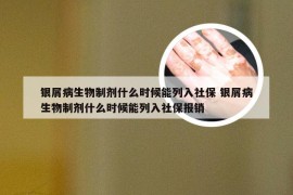 银屑病生物制剂什么时候能列入社保 银屑病生物制剂什么时候能列入社保报销