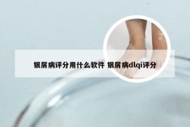 银屑病评分用什么软件 银屑病dlqi评分