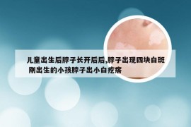 儿童出生后脖子长开后后,脖子出现四块白斑 刚出生的小孩脖子出小白疙瘩