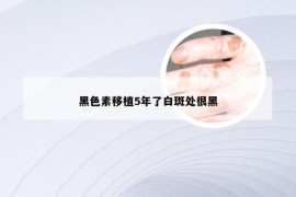 黑色素移植5年了白斑处很黑