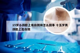 15岁小孩脸上有白斑块怎么回事 十五岁男孩脸上出白斑