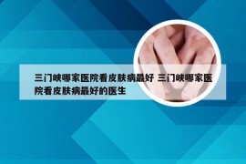 三门峡哪家医院看皮肤病最好 三门峡哪家医院看皮肤病最好的医生