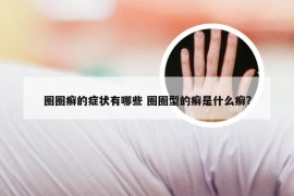 圈圈癣的症状有哪些 圈圈型的癣是什么癣?