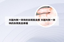 大腿内侧一块块的白斑而且痒 大腿内侧一块块的白斑而且痒痛