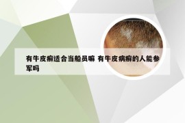 有牛皮癣适合当船员嘛 有牛皮病癣的人能参军吗