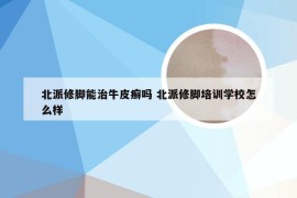 北派修脚能治牛皮癣吗 北派修脚培训学校怎么样