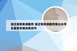 宿迁是银屑病医院 宿迁银屑病医院搜公众号名医堂良媒自助挂号