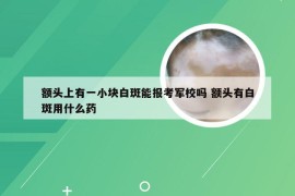 额头上有一小块白斑能报考军校吗 额头有白斑用什么药