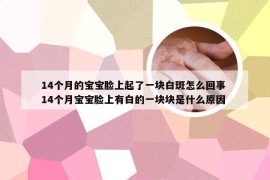 14个月的宝宝脸上起了一块白斑怎么回事 14个月宝宝脸上有白的一块块是什么原因