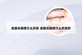 皮肤长藓擦什么药膏 皮肤长藓擦什么药膏好