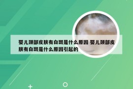 婴儿颈部皮肤有白斑是什么原因 婴儿颈部皮肤有白斑是什么原因引起的