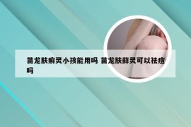 苗龙肤癣灵小孩能用吗 苗龙肤藓灵可以祛痘吗