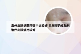 泉州皮肤病医院哪个比较好 泉州哪的皮肤科治疗皮肤病比较好