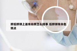 脖后脖颈上面有白斑怎么回事 后脖颈有白色斑点