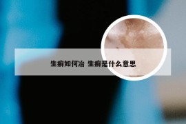 生癣如何冶 生癣是什么意思