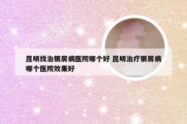 昆明找治银屑病医院哪个好 昆明治疗银屑病哪个医院效果好