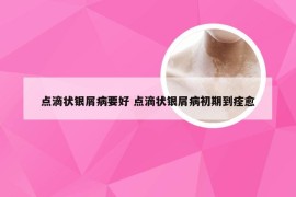 点滴状银屑病要好 点滴状银屑病初期到痊愈