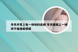 冬天手臂上有一块块的皮癣 冬天胳膊上一块块干燥像癣很痒