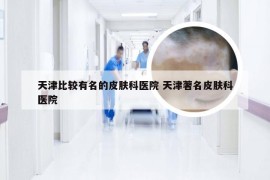 天津比较有名的皮肤科医院 天津著名皮肤科医院