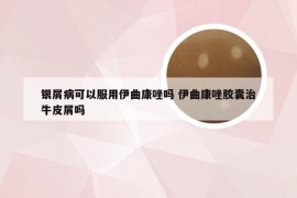 银屑病可以服用伊曲康唑吗 伊曲康唑胶囊治牛皮屑吗