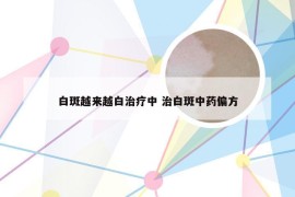 白斑越来越白治疗中 治白斑中药偏方