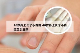 40岁身上长了小白斑 40岁身上长了小白斑怎么回事