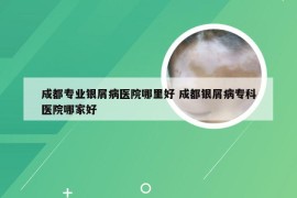 成都专业银屑病医院哪里好 成都银屑病专科医院哪家好