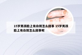 15岁男孩脸上有白斑怎么回事 15岁男孩脸上有白斑怎么回事呢