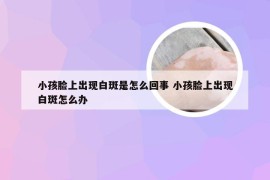 小孩脸上出现白斑是怎么回事 小孩脸上出现白斑怎么办