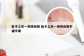 肚子上长一块块白斑 肚子上长一块块白斑不痛不痒