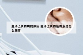 肚子上长白斑的原因 肚子上长白色斑点是怎么回事