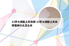 13岁小孩脸上长白斑 13岁小孩脸上长白斑是缺什么怎么补