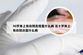 50岁身上有白斑出现是什么病 五十岁身上有白斑点是什么病