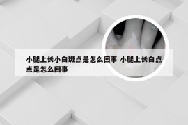 小腿上长小白斑点是怎么回事 小腿上长白点点是怎么回事