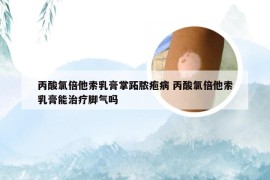 丙酸氯倍他索乳膏掌跖脓疱病 丙酸氯倍他索乳膏能治疗脚气吗