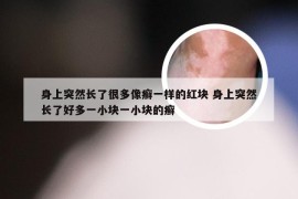 身上突然长了很多像癣一样的红块 身上突然长了好多一小块一小块的癣