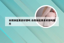 白斑抹促黑素好使吗 白斑抹促黑素好使吗图片