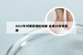 2023年对银屑病的攻破 未来20年银屑病