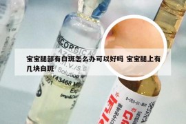 宝宝腿部有白斑怎么办可以好吗 宝宝腿上有几块白斑