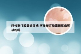 阿伐斯汀胶囊银屑病 阿伐斯汀胶囊银屑病可以吃吗