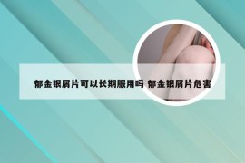 郁金银屑片可以长期服用吗 郁金银屑片危害